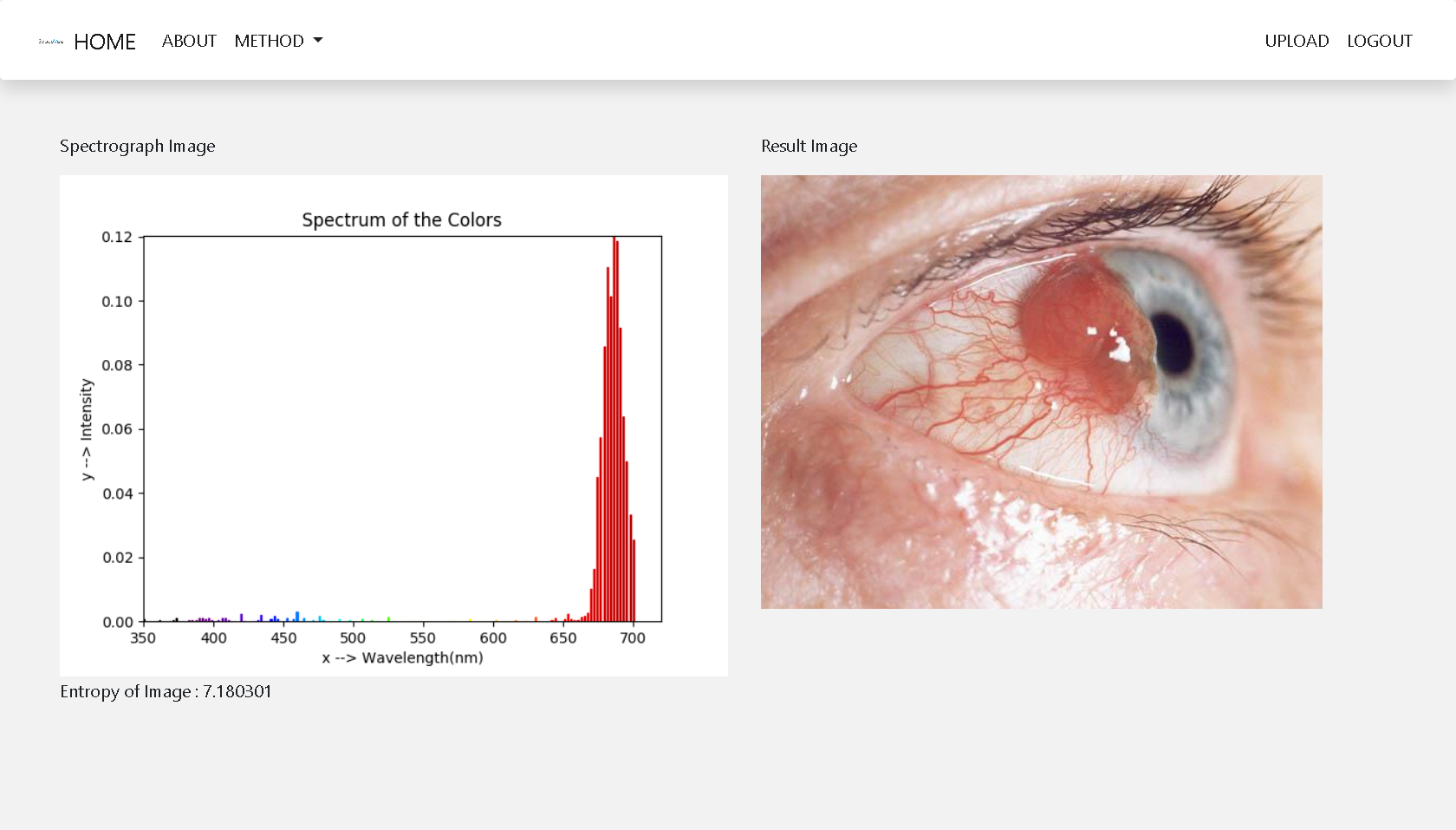 Eye-Melanoma-Emission-Spectra-1
